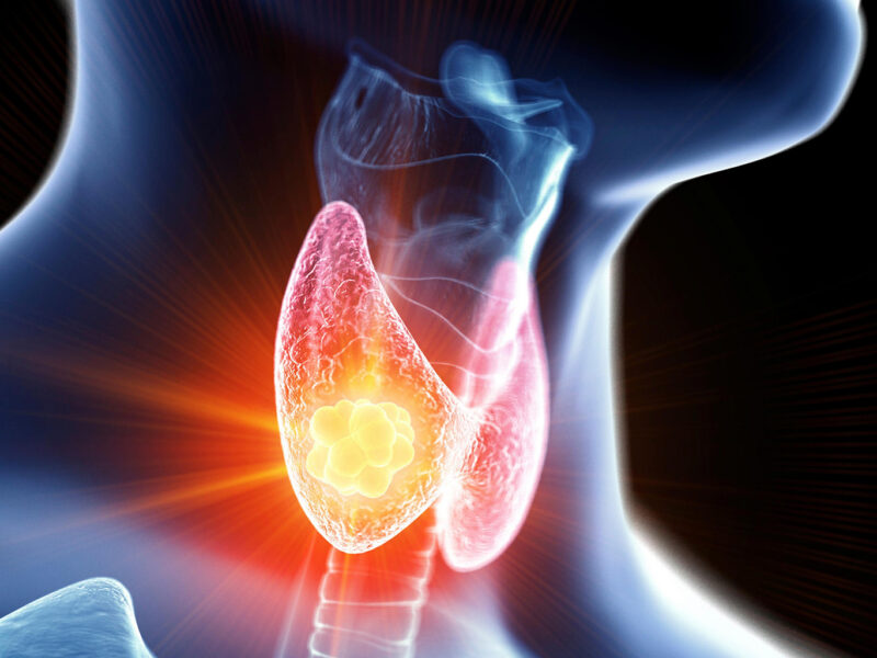 Dr. Robledo Alievi Cirurgião; cirurgião de cabeça e pescoço RS; ablação percutânea de nódulo de tireoide; cirurgia para câncer de tireoide; tratamento câncer de pele no rosto; cirurgia de nódulo na tireoide; Clínica Vitaro Ijuí RS; reconstrução facial pós câncer de pele; especialista em câncer de laringe; cirurgia de glândulas salivares; tratamento minimamente invasivo tireoide; segunda opinião para cirurgia de cabeça e pescoço; oncologia cirúrgica Ijuí; malformação congênita no pescoço tratamento; telemedicina cirurgião de cabeça e pescoço;lesões na laringe;rouquidão persistente;reconstrução facial;carcinoma basocelular;manchas e sinais no rosto;ablação percutânea;nódulo na tireoide;caroço no pescoço